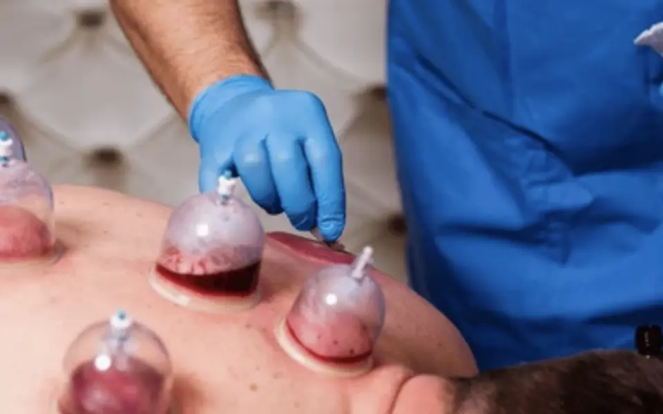 Hijama Institute USA